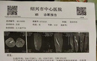 浙江男籃吳前右大腿水腫，傷停三周。